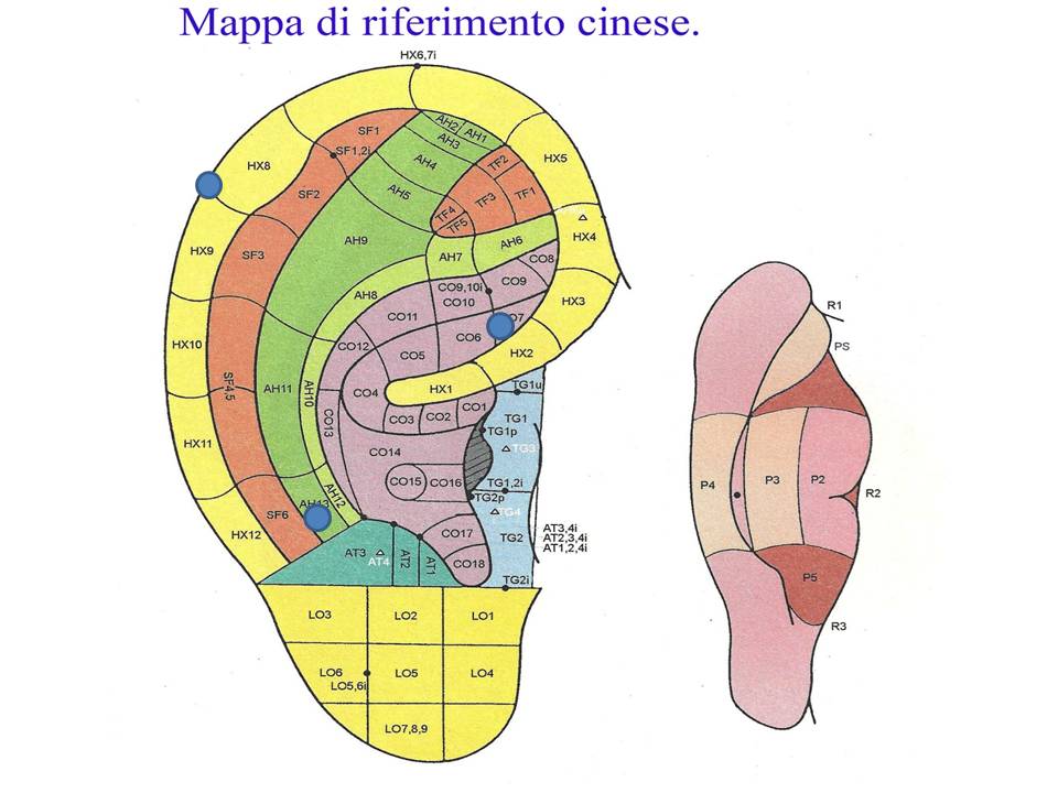 Auricoloterapia